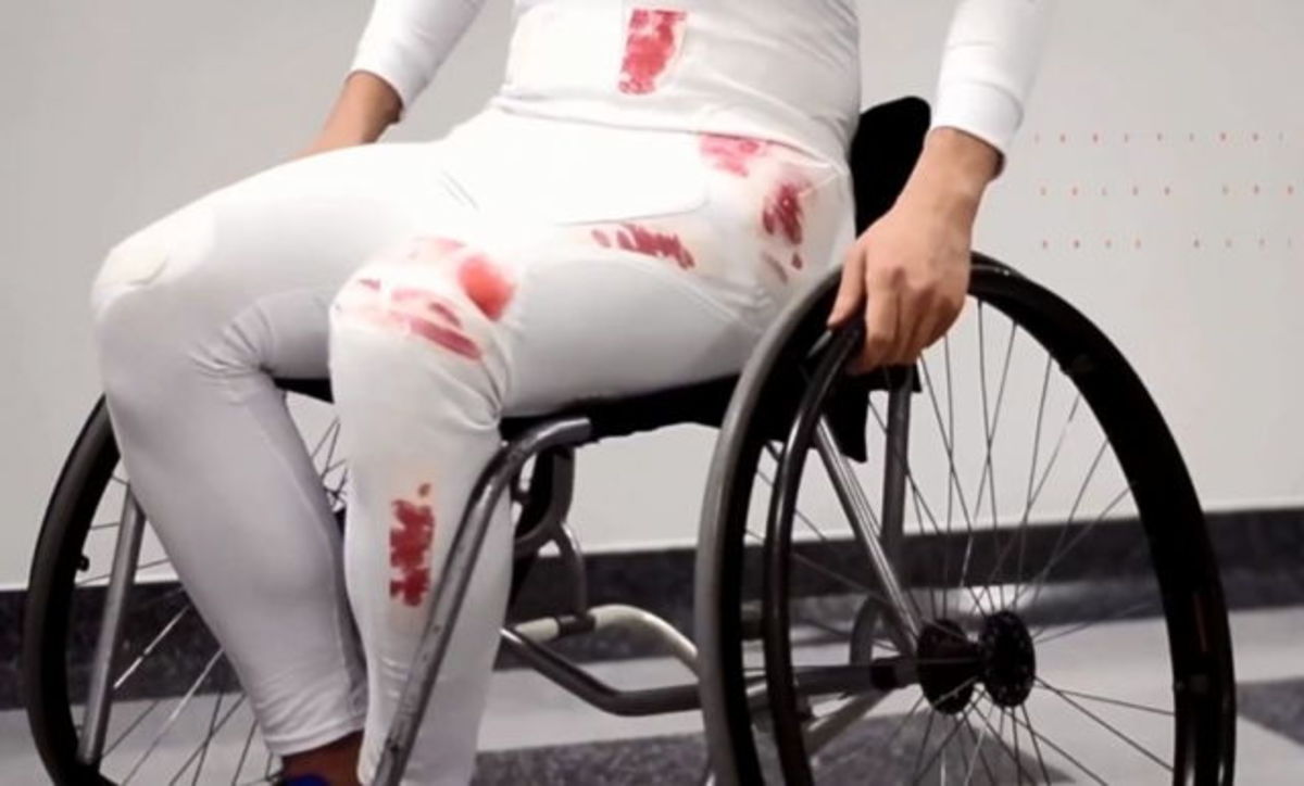 Bruise pants in the flesh
